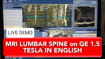 Lumbar Spine MRI scan protocol, positioning and planning on GE 1.5 Tesla | Live Demo in English.
