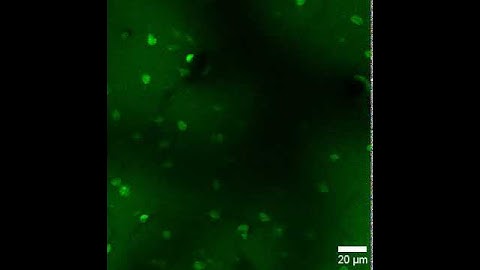 In Vivo two-photon imaging of Aβ-pH in the mouse barrel cortex.