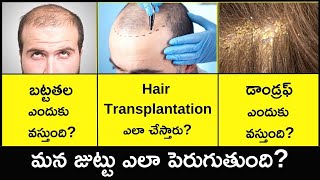 How Your Hair Grows | How to Stop Hair Fall & Dandruff in Telugu | | Hair Transplantation Explained