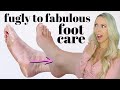 ULTIMATE AT HOME FOOT CARE! *Feet Transformation*