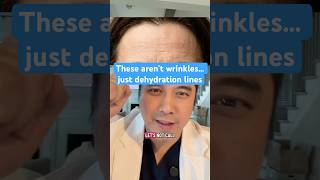 Those aren't wrinkles... just dehydration lines