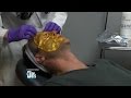 Dr. Travis Gets His First Facial