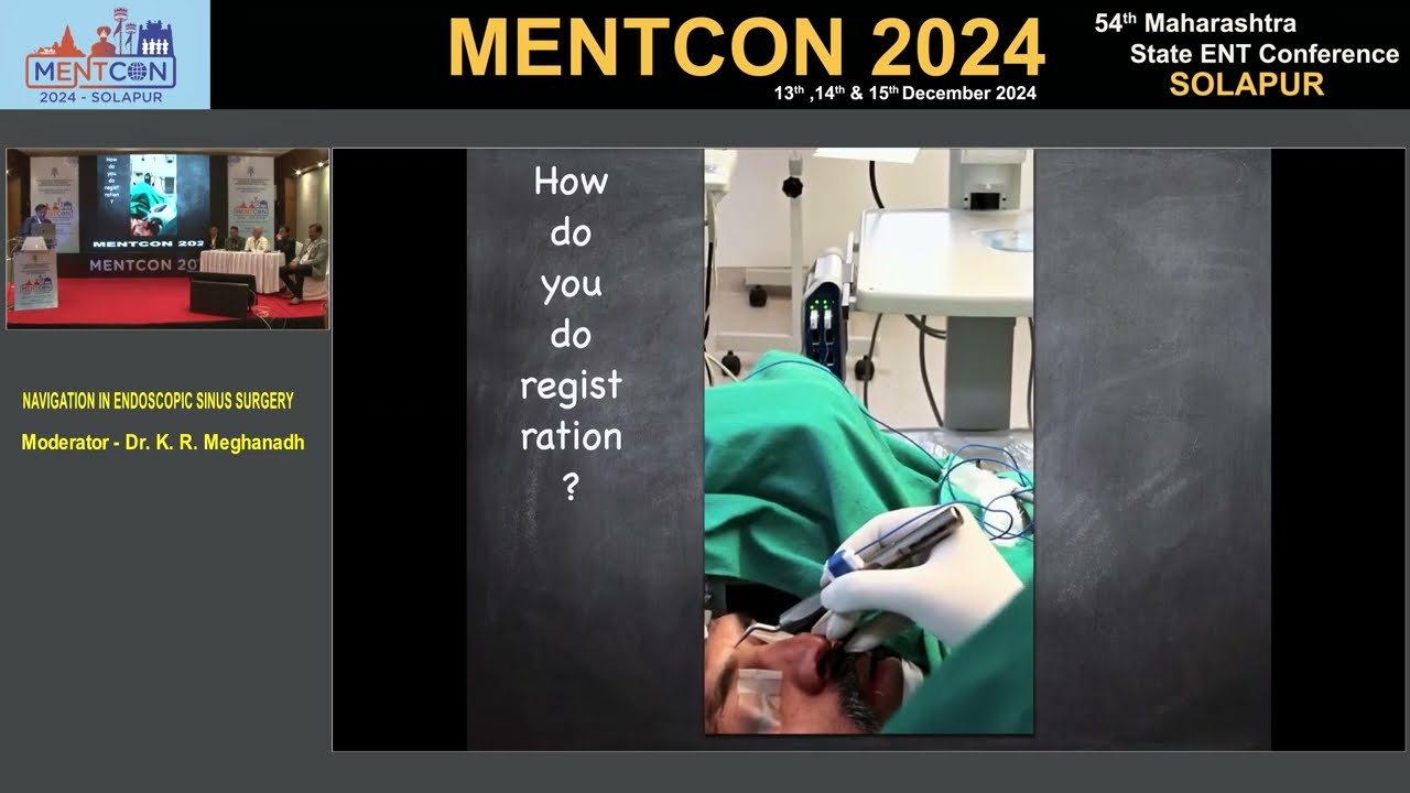 NAVIGATION IN ENDOSCOPIC SINUS SURGERY : PANEL DISCUSSION