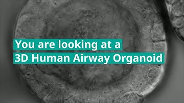3D Human Airway Organoids: A Research Tool for Respiratory Disease Researchers