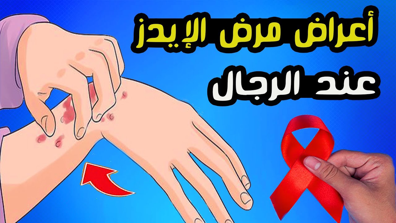 أعراض مرض الإيدز عند الرجال