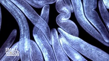 A Dense Culture of a Freshwater Ciliate | 2023 Nikon Small World