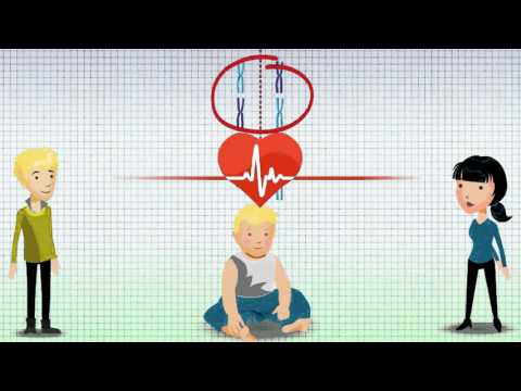 Vidéo: Qu'est-ce que le syndrome de translocation ?