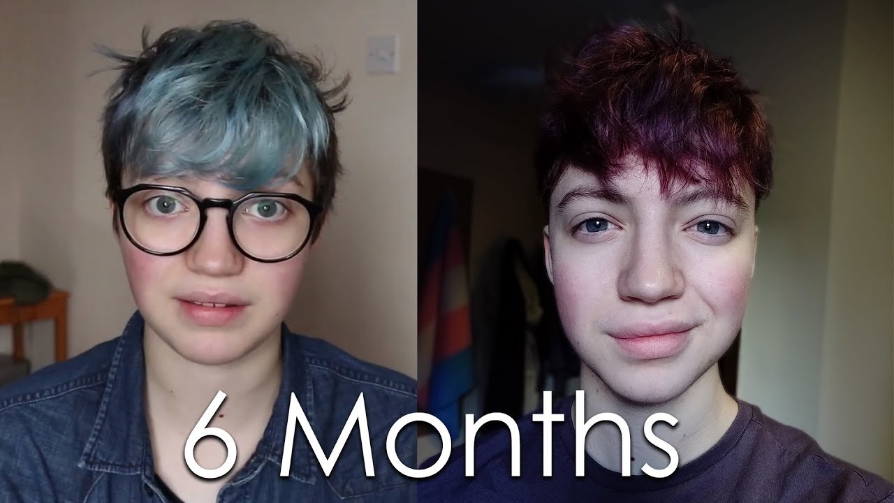 Six Months on Testosterone // FTM Transition (Voice Timeline) - YouTube