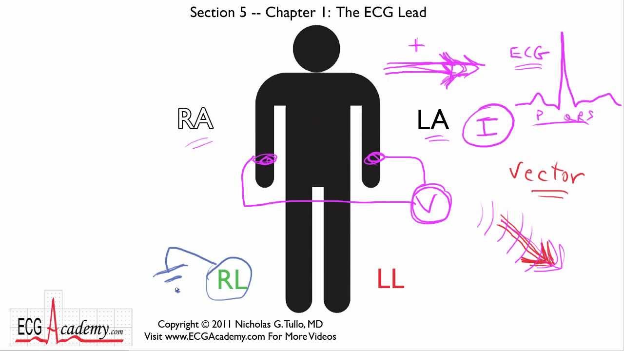 Ecg Electrode Placement Chart