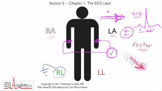 Basics of ECG Leads 5-1 - ECG / EKG Interpretation -- BASIC screenshot 5