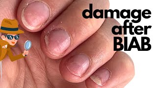 How to correct damage after BIAB (Builder in a bottle) [Annas Nail Advice]