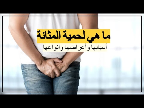 لحمية المثانة ما هي لحمية المثانة وأسبابها وأعراضها وانواعها وطرق علاجها