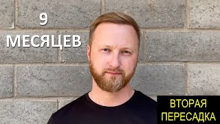 9 МЕСЯЦЕВ ПОСЛЕ 2 ПЕРЕСАДКИ ВОЛОС