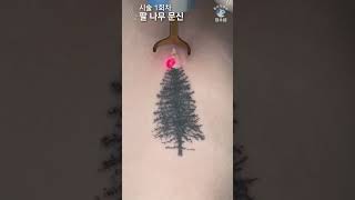 팔 안쪽 나무 문신(타투)제거 [Laser Tattoo Removal]