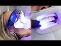 Is professional teeth whitening really worth it? Celebrity dentist spills all | Glam Lab