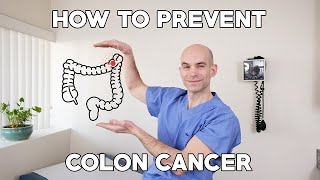 FOLLOW THIS DOCTOR'S ADVICE TO PREVENT COLON CANCER!