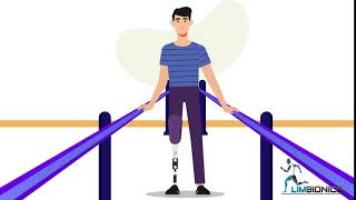 Amputee Weight Shift- Side to Side
