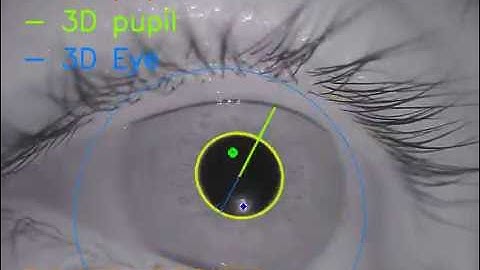 Fast, Accurate, Open-source Eye Tracking