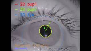Fast, Accurate, Open-source Eye Tracking