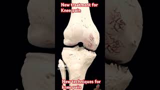 Treat Ur Knee Pain with One Injection?Ultimate Knee pain Treatment exercise kneepain knee short