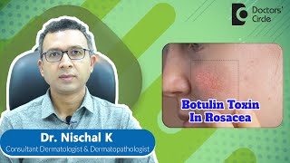 ROSACEA TREATMENT WITH BOTOX| FACE FLUSHING TREATMENT #botox #rosacea -Dr. Nischal K|Doctors' Circle