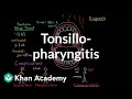 Tonsillopharyngitis - Complications, diagnosis, and treatment | NCLEX-RN | Khan Academy