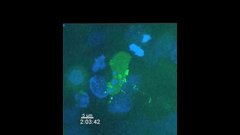 HIV-Infected Cell Sheds Virus and Leaves