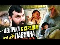 Пересадка сердца павиана? Трагическая история Бэби Фэй