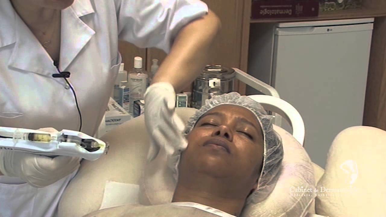 Mésothérapie visage, cou et mains