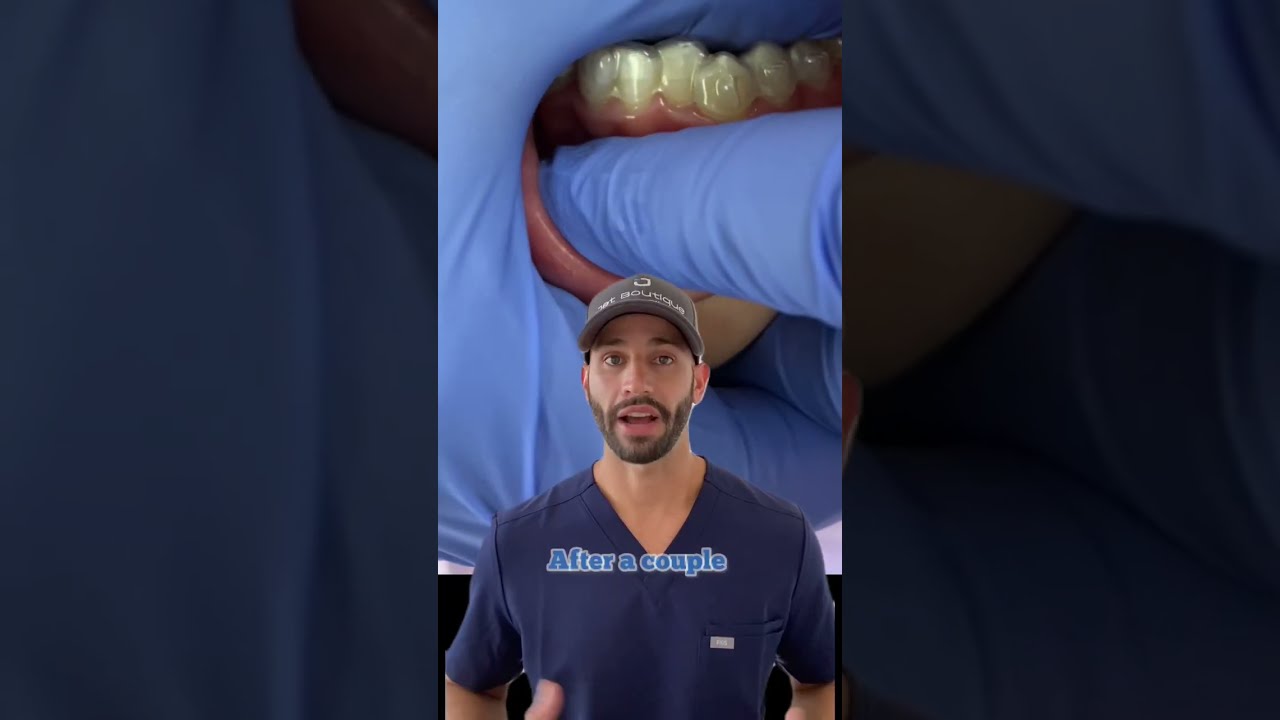 Invisalign Pain Will It Hurt And Is Better Or Worse Than Braces 