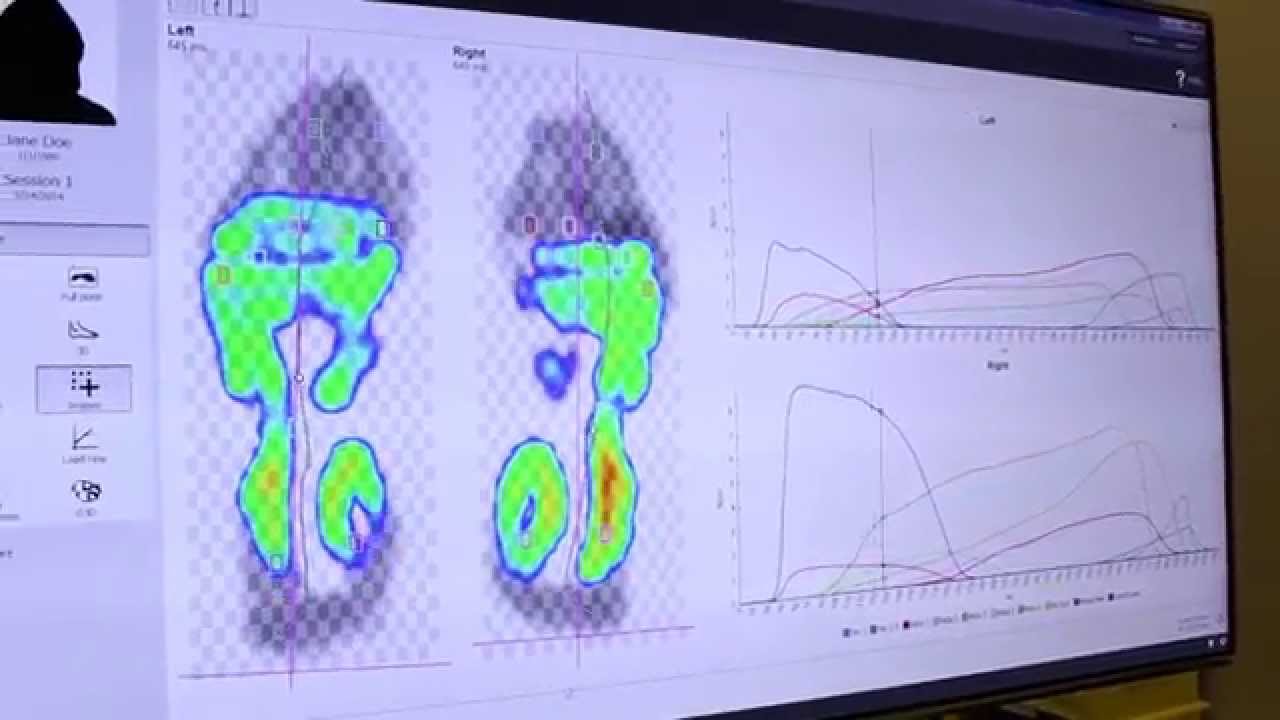 Dynamic Gait Analysis And Pressure Plate System