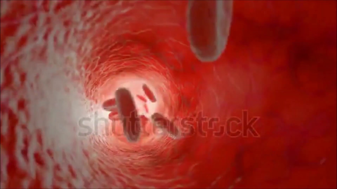 Test de Equilibrio Peritoneal