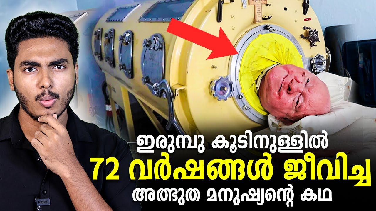 72 വർഷം അയാൾ എങ്ങനെ അതിനകത്തു ജീവിച്ചു 😱 PAUL ALEXANDER STORY | MALAYALAM | AFWORLD BY AFLU