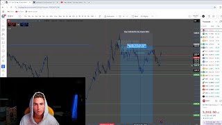Live Day Trading Making $47,600 (I MADE 200K IN 2 DAYS)