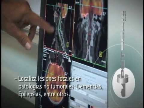 Vídeo: PET Scan: Definición, Propósito, Procedimiento Y Resultados