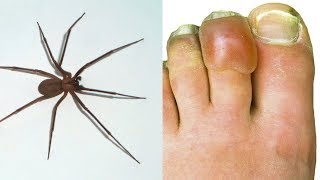 MOST Dangerous Spiders On Earth