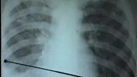 11 Lao Ke Lao MP[bacsihoasung.wordpress.com].wmv