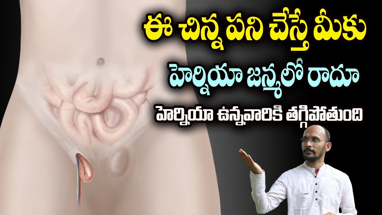 ఈ చిన్న పని చేస్తే మీకు హెర్నియా జన్మలో రాదూ, హెర్నియా ఉన్నవారికి తగ్గిపోతుంది| Dr.Madhu BabuHealth