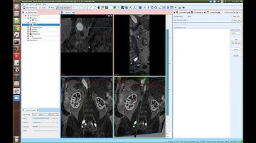 SimVascular Tutorial 2: Creating centerline paths