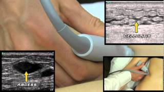 Soft Tissue Ultrasound from One Minute Ultrasound screenshot 4