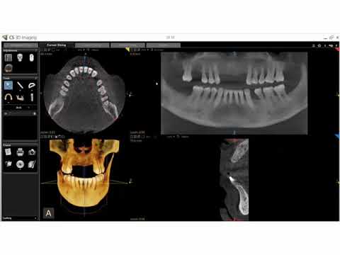 CS 3D Imaging
