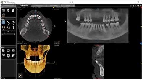 CS 3D Imaging software-Reconstructing a Panoramic Image