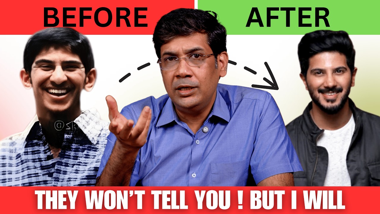 Why the modern Indian men do plastic surgery ??  Interesting statistics !!