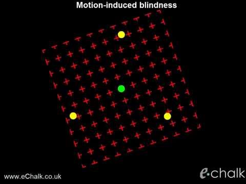 Motion-induced blindness: test for the severity of ADHD : eChalk illusion