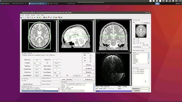 MRiLab ISMRM 2019 Video Demo #5: Simulate Multi-channel Receiving for Parallel Imaging