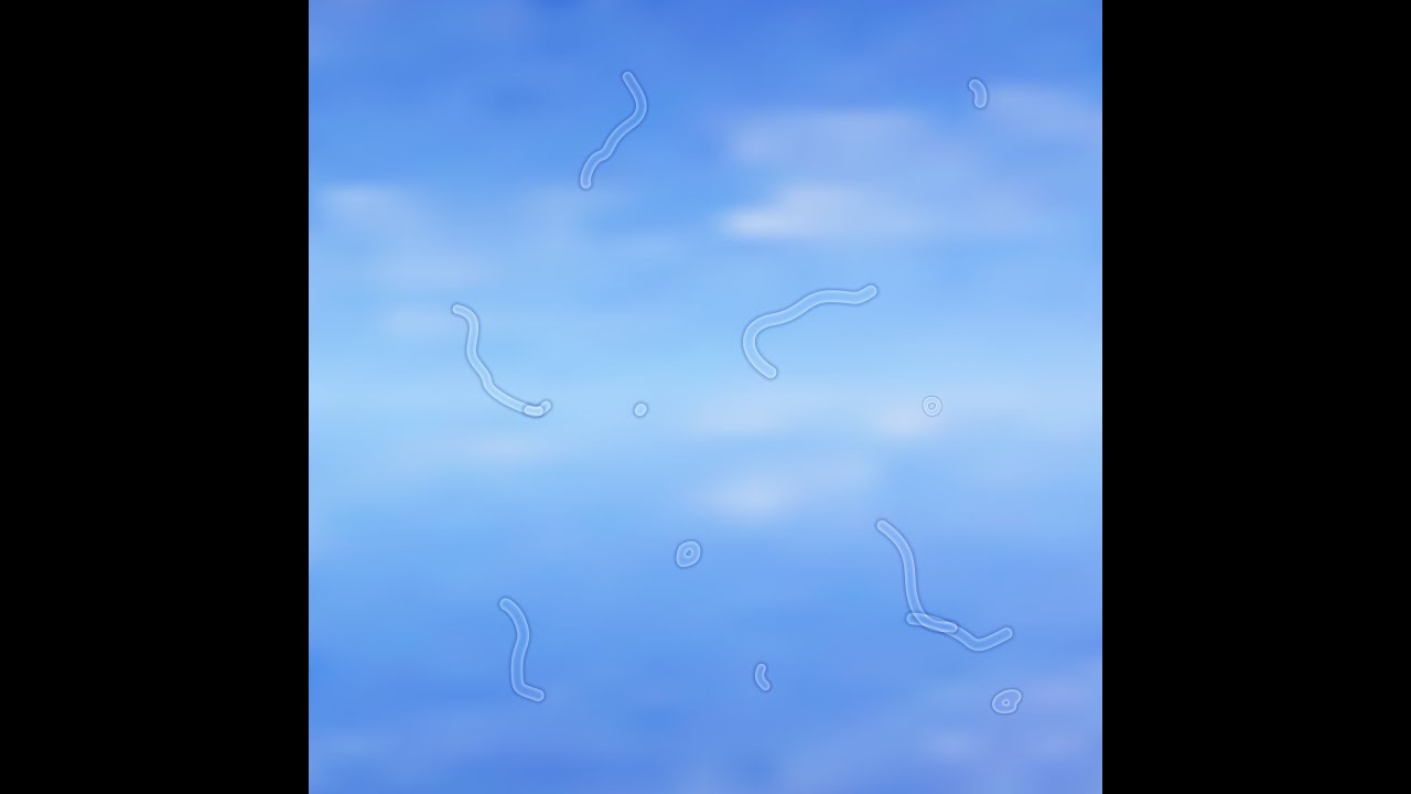 Learn about eye floaters YouTube