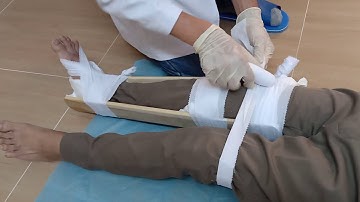Bài 17: Hướng dẫn cố định gãy xương cẳng chân