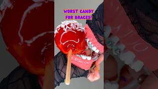 CANDY / FOODS YOU CAN'T EAT WITH BRACES ON HALLOWEEN EDITION ORTHODONTIST REACTS CRUNCHY FOOD ASMR screenshot 4