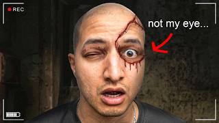 WHAT HAPPENED TO MY FACE...?