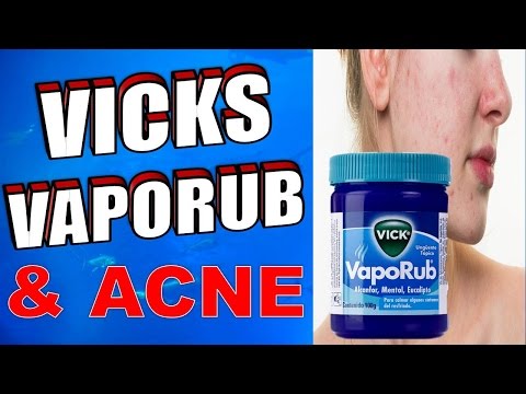 How to Use Vicks Vaporub to Treat Cystic Acne